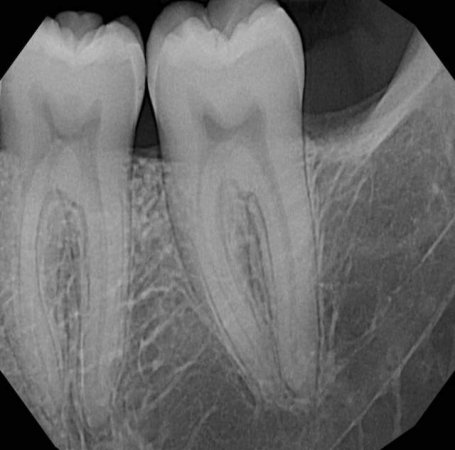 Shitet Grafi dentare Panorameks i vitit 2015, 8.000 €