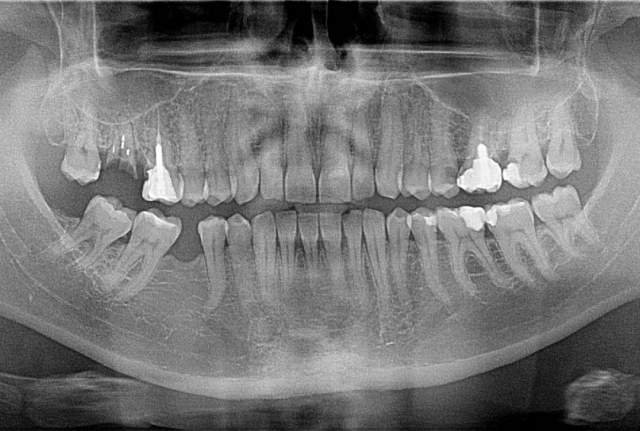 Shitet Grafi dentare Panorameks i vitit 2015, 8.000 €