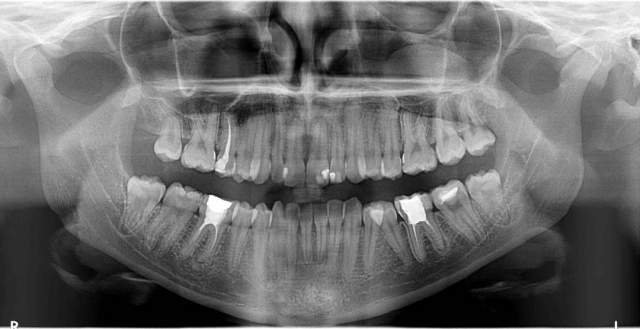 Shitet Grafi dentare Panorameks i vitit 2015, 8.000 €