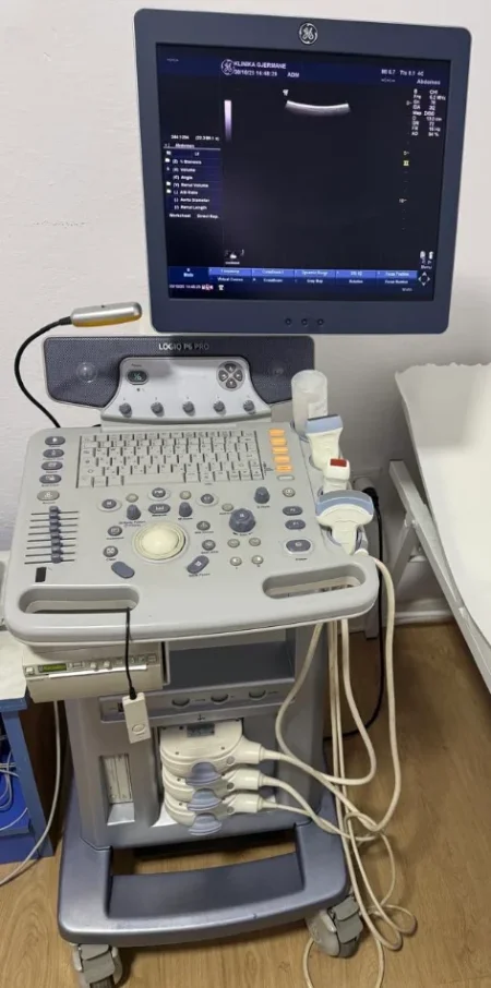 Tirane, shes Ultrasound ECHO Shitet Ekograf Profesional GE Logiq P6 Pro
