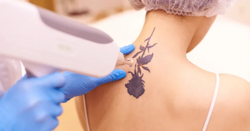 Tirane, shes pajisje laser LASER Q SWITCHED 532nm. 755nm. 1064nm. 1320nm 1 €