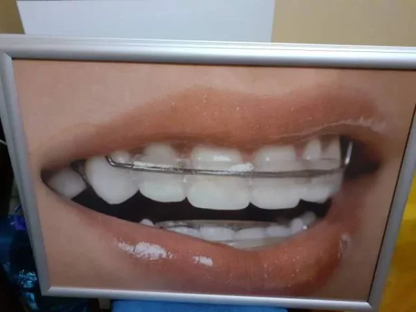 Tirane, Mjete dentare