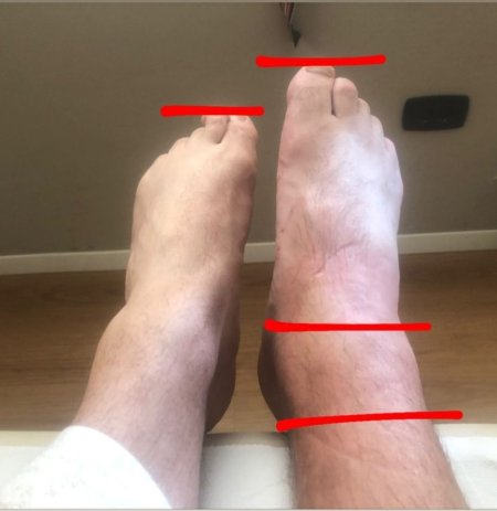 Tirane, ofroj Fizioterapi profesionale ne shtepine tuaj.