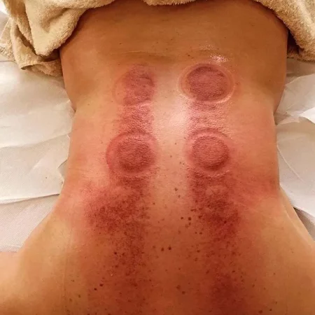 Tirane, ofroj Fizioterapi profesionale ne shtepine tuaj.